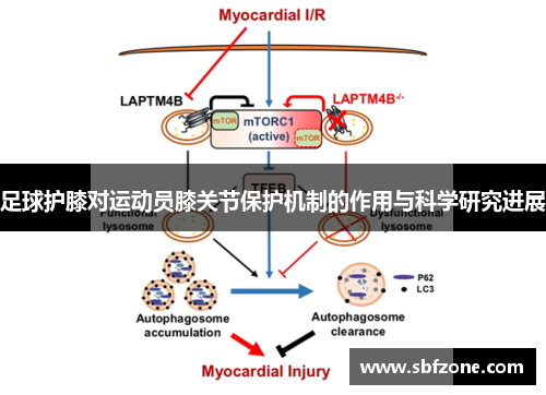足球护膝对运动员膝关节保护机制的作用与科学研究进展